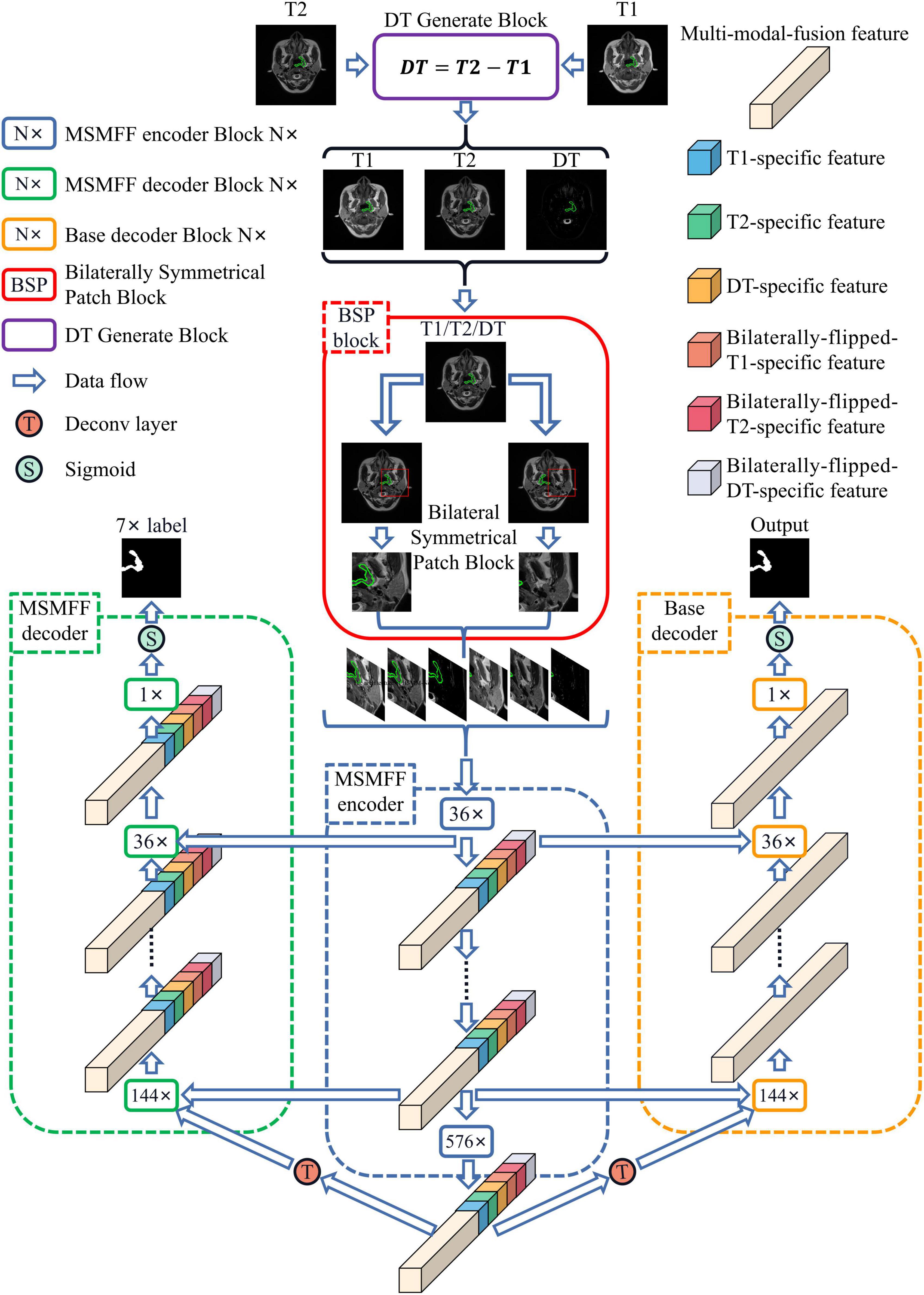 BSMM-Net: Multi-modal neural network based on bilateral symmetry for nasopharyngeal carcinoma segmentation